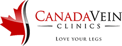 Canada Vein Clinics, love your legs