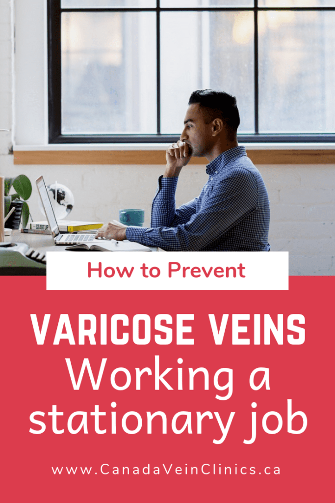 What You Need to Know About Your Stationary Job and Varicose Veins